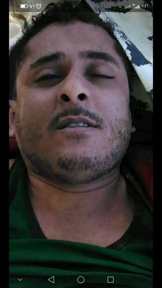 عقب اختطافه ل٧ سنوات .. وفاة مواطن في سجون الحوثيين بتعز
