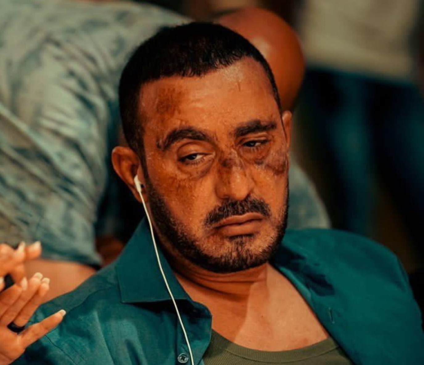 تسمم في الدم.. أحمد السقا يكشف بالفيديو تفاصيل أزمته الصحية