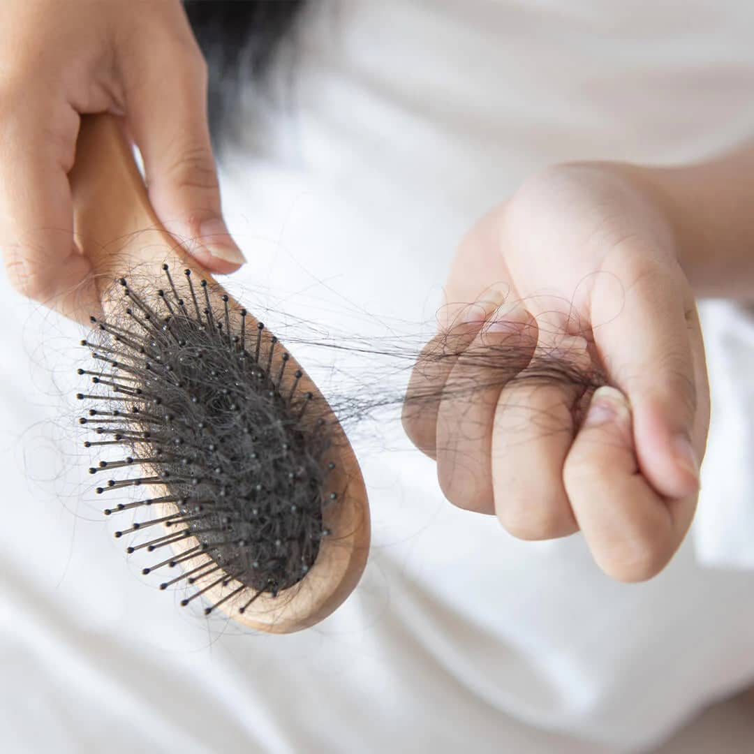 معلومات حول تساقط الشعر بعد الولادة.. هل تحتاج علاج؟