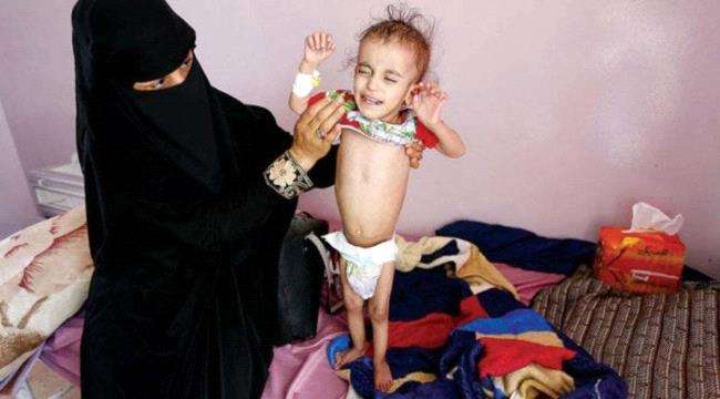 وفاة الفين مواطن يمني عقب تعرضهم لهذا الوباء