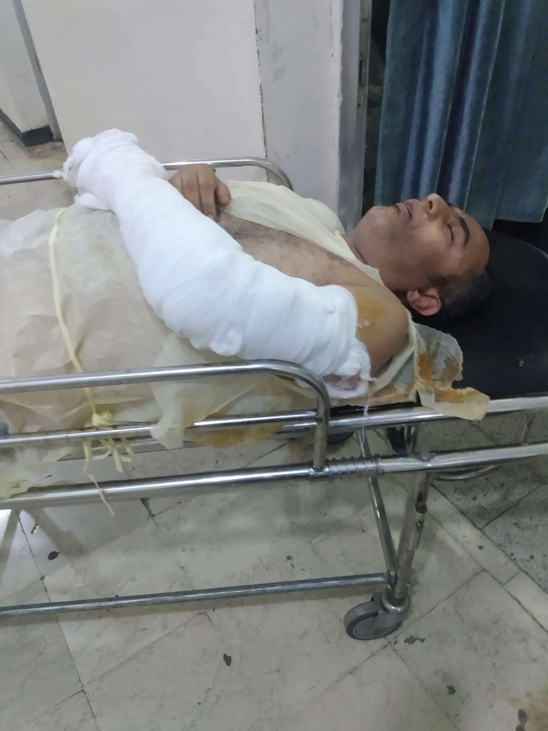 عازف يمني شهير يخضع لإجراء عملية جراحية