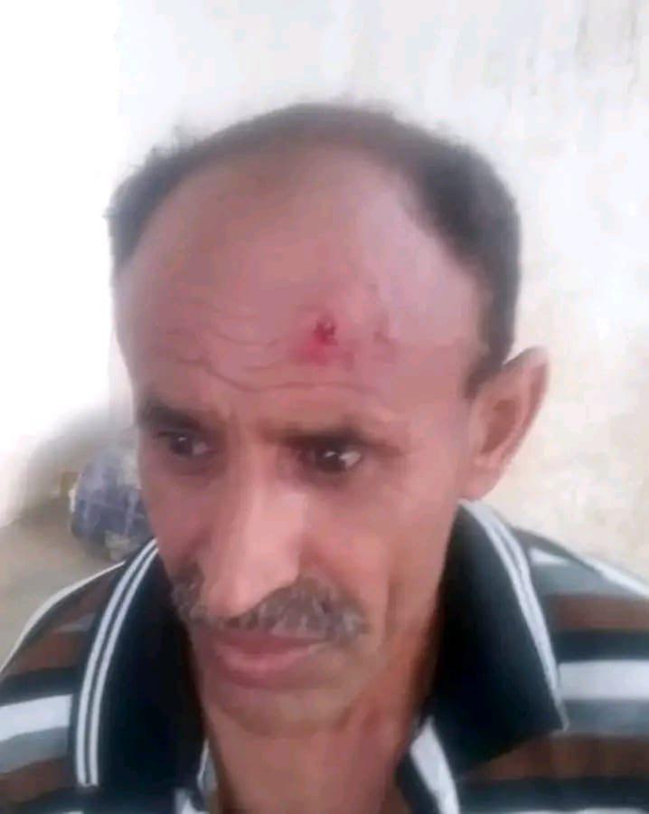 قيادي حوثي يعتدي بالضرب على جندي في أمن الجراحي بالحديدة