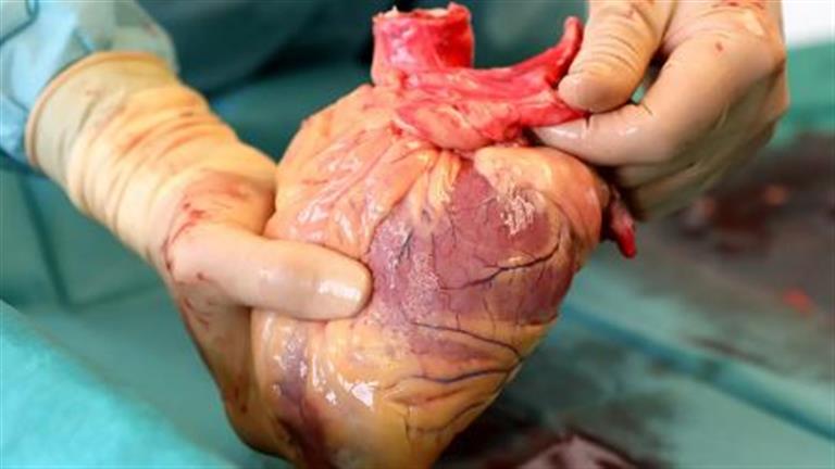 ثورة في نقل الأعضاء.. تقنية جديدة تحافظ على صحة القلب لأكثر